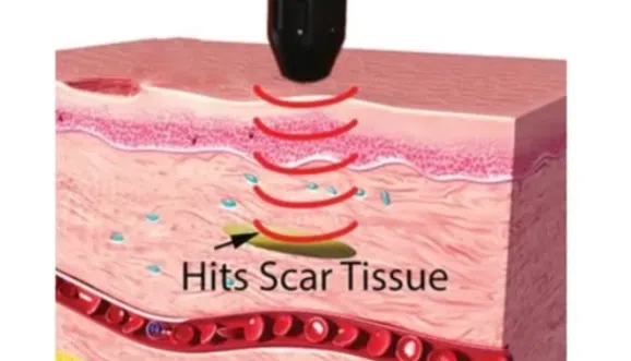 image of Hits Scar Tissue